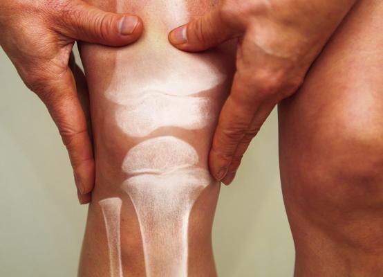 Know your osteoporosis risk