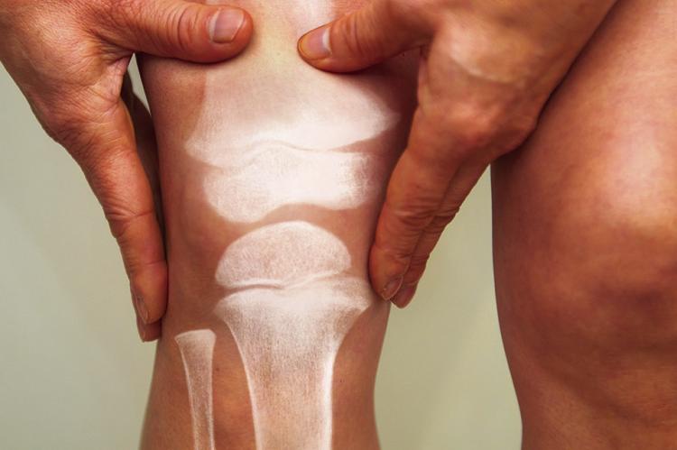 Know your osteoporosis risk
